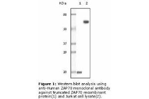 Image no. 2 for anti-zeta-Chain (TCR) Associated Protein Kinase 70kDa (ZAP70) antibody (ABIN207619) (ZAP70 Antikörper)