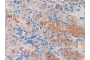 Immunohistochemistry (IHC) image for anti-Slit Homolog 1 (SLIT1) (AA 647-835) antibody (ABIN7438364)