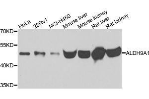 Western blot analysis of extracts of various cell lines, using ALDH9A1 antibody (ABIN5995392) at 1/500 dilution. (ALDH9A1 Antikörper)