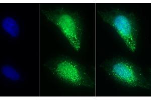 Detection of ST2 in Human U2OS cell using Polyclonal Antibody to Syntenin 2 (ST2) (SDCBP2 Antikörper  (AA 1-292))