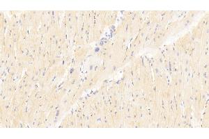 Immunohistochemistry (IHC) image for anti-TNF Receptor-Associated Factor 6 (TRAF6) (AA 153-423) antibody (ABIN7436348)
