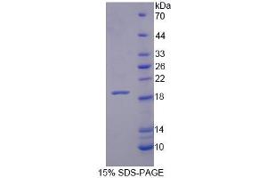 SDS-PAGE analysis of Human XYLT1 Protein. (XYLT1 Protein)