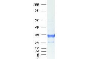 Western Blotting (WB) image for HLA-DR-gamma (CD74) (Transcript Variant 1) protein (Myc-DYKDDDDK Tag) (ABIN2713774)