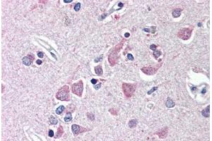 Human Brain, Cortex (formalin-fixed, paraffin-embedded) stained with FEM1B antibody ABIN214493 at 10 ug/ml followed by biotinylated goat anti-rabbit IgG secondary antibody ABIN481713, alkaline phosphatase-streptavidin and chromogen. (FEM1B Antikörper  (AA 609-622))