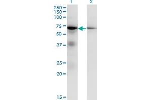 Western Blotting (WB) image for anti-Eukaryotic Translation Initiation Factor 2-alpha Kinase 2 (EIF2AK2) (AA 1-101) antibody (ABIN598900) (EIF2AK2 Antikörper  (AA 1-101))