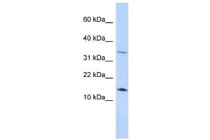 Leptin antibody used at 1 ug/ml to detect target protein. (Leptin Antikörper  (Middle Region))