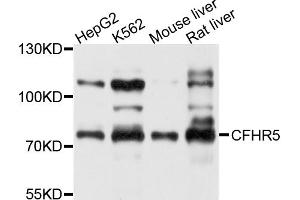 Western blot analysis of extracts of various cell lines, using CFHR5 antibody (ABIN5997428) at 1/1000 dilution. (CFHR5 Antikörper)
