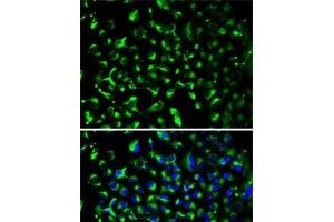 Immunofluorescence analysis of HeLa cells using PHB Polyclonal Antibody (Prohibitin Antikörper)