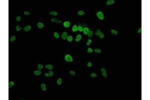 Immunofluorescence staining of Hela cells with ABIN7139625 at 1:2. (HIST1H1E Antikörper  (pThr17))