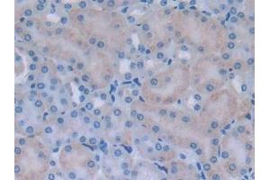 Immunohistochemistry (IHC) image for anti-Myosin Light Chain Kinase 2 (MYLK2) (AA 330-548) antibody (ABIN7443779)