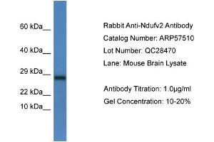 Western Blotting (WB) image for anti-NADH Dehydrogenase (Ubiquinone) Flavoprotein 2, 24kDa (NDUFV2) (C-Term) antibody (ABIN2787254) (NDUFV2 Antikörper  (C-Term))
