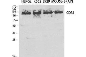 Western Blot (WB) analysis of specific cells using CD31 Polyclonal Antibody. (CD31 Antikörper  (Thr224))