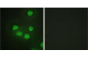 Immunofluorescence analysis of HepG2 cells, using SIX6 Antibody. (SIX Homeobox 6 Antikörper  (AA 121-170))