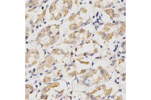 Immunohistochemistry of paraffin-embedded human stomach using CDC20 antibody at dilution of 1:200 (x400 lens)