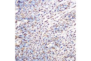 Immunohistochemistry of paraffin-embedded human esophageal using GLUD1 Rabbit mAb (ABIN7267411) at dilution of 1:100 (40x lens).