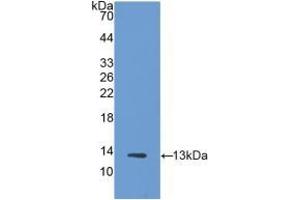 Detection of Recombinant Trx, Human using Polyclonal Antibody to Thioredoxin (Trx) (TXN Antikörper  (AA 1-105))