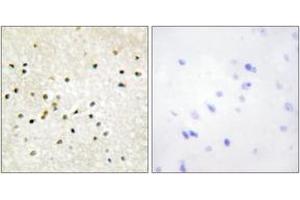 Immunohistochemistry analysis of paraffin-embedded human brain tissue, using TF2H1 Antibody. (GTF2H1 Antikörper  (AA 15-64))