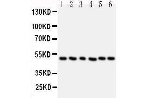 Anti-HDAC3 antibody,  Western blotting Lane 1: Rat Stomach Tissue Lysate Lane 2: Rat Testis Tissue Lysate Lane 3: MCF-7 Cell Lysate Lane 4: HELA Cell Lysate Lane 5: JURKAT Cell Lysate Lane 6: SKOV Cell Lysate