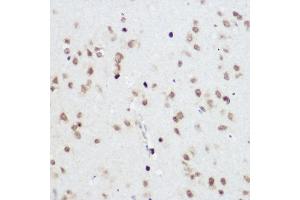 Immunohistochemistry of paraffin-embedded Rat brain using PLZF antibody (ABIN6128472, ABIN6150368, ABIN6150369 and ABIN6221570) at dilution of 1:200 (40x lens). (ZBTB16 Antikörper  (AA 1-220))