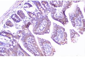 IHC analysis of cortactin using anti-cortactin antibody (ABIN6719306).