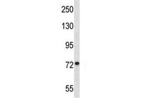 MFN1 antibody western blot analysis in Jurkat lysate. (MFN1 Antikörper  (AA 353-381))
