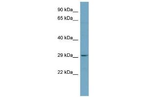Western Blotting (WB) image for anti-Platelet-Activating Factor Acetylhydrolase 1b, Catalytic Subunit 2 (30kDa) (PAFAH1B2) (N-Term) antibody (ABIN2787713)