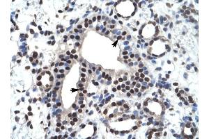 ZNF499 antibody was used for immunohistochemistry at a concentration of 4-8 ug/ml to stain Epithelial cells of collecting tubule (arrows) in Human Kidney.