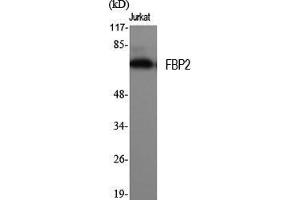 Western Blot (WB) analysis of specific cells using FBP2 Polyclonal Antibody. (FBP2 Antikörper  (N-Term))