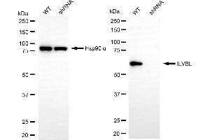 Western blotting analysis using ILVBL antibody (ABIN7799022).