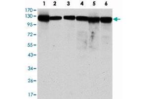 Western blot analysis using MCM2 monoclonal antibody, clone 1E7  against MCF-7 (1), HeLa (2), Jurkat (3), K-562 (4), HEK293 (5) and HEPG2 (6) cell lysate. (MCM2 Antikörper)