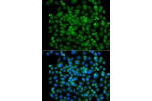 Immunofluorescence analysis of A549 cell using PSMB8 antibody. (PSMB8 Antikörper)