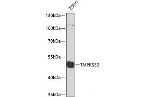 Western blot analysis of extracts of 22Rv1 cells using TMPRSS2 Polyclonal Antibody at dilution of 1:2000. (TMPRSS2 Antikörper)