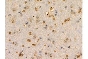ABIN6259152 and ABIN6274301 at 1/100 staining Rat brain tissue by IHC-P. (PITX1 Antikörper  (Internal Region))