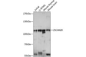 Western blot analysis of extracts of various cell lines, using ZSC antibody (ABIN7271443) at 1:1000 dilution. (ZSCAN20 Antikörper  (AA 1-200))