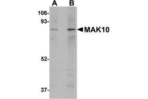 Western Blotting (WB) image for anti-MAK10 Homolog, Amino-Acid N-Acetyltransferase Subunit (MAK10) (Middle Region) antibody (ABIN1030993) (MAK10/NAA35 Antikörper  (Middle Region))