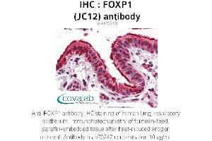 Image no. 1 for anti-Forkhead Box P1 (FOXP1) antibody (ABIN5693578) (FOXP1 Antikörper)
