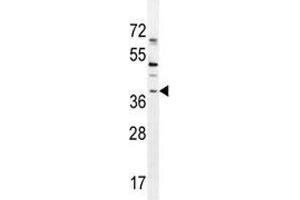 SOX1 antibody western blot analysis in NCI-H460 lysate. (SOX1 Antikörper  (AA 47-76))