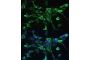 Immunofluorescence analysis of NIH-3T3 cells using COX6 Polyclonal Antibody (ABIN6132108, ABIN6138915, ABIN6138916 and ABIN6220368) at dilution of 1:100 (40x lens). (COX6A1 Antikörper  (AA 25-109))