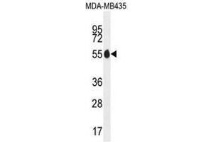 PAX1 Antibody (N-term) western blot analysis in MDA-MB435 cell line lysates (35µg/lane).