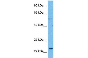 Host:  Rabbit  Target Name:  CACNG1  Sample Tissue:  Human Lung Tumor  Antibody Dilution:  1ug/ml (CACNG1 Antikörper  (N-Term))