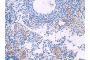 Detection of CDK1 in Mouse Ovary Tissue using Polyclonal Antibody to Cyclin Dependent Kinase 1 (CDK1) (CDK1 Antikörper  (AA 59-181))