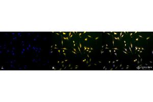 Immunocytochemistry/Immunofluorescence analysis using Rabbit Anti-Rab5 Polyclonal Antibody . (RAB5 Antikörper  (Atto 594))