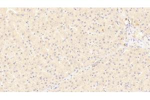 Detection of LRP5 in Human Liver Tissue using Polyclonal Antibody to Low Density Lipoprotein Receptor Related Protein 5 (LRP5) (LRP5 Antikörper  (AA 769-1016))