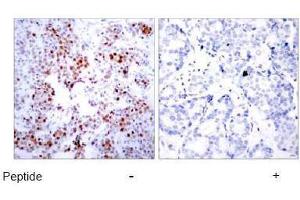 Image no. 1 for anti-Activating Transcription Factor 2 (ATF2) (Ser44), (Ser62) antibody (ABIN197144) (ATF2 Antikörper  (Ser44, Ser62))