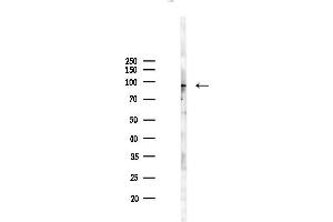 anti-Chromosome X Open Reading Frame 23 (CXORF23) antibody