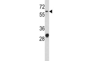 Western blot analysis of CD166 antibody and NCI-H460 lysate. (CD166 Antikörper  (AA 58-87))