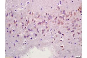 Formalin-fixed and paraffin embedded rat brain labeled with Anti-MAPK11 Polyclonal Antibody, Unconjugated (ABIN754393) at 1:200 followed by conjugation to the secondary antibody and DAB staining (MAPK11 Antikörper  (AA 21-120))