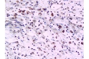 Formalin-fixed and paraffin embedded rat colon tissue labeled with Anti-PTAFR Polyclonal Antibody, Unconjugated (ABIN687127) at 1:200 followed by conjugation to the secondary antibody and DAB staining (PTAFR Antikörper  (AA 231-342))