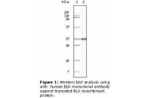 Image no. 2 for anti-B Lymphoid Tyrosine Kinase (BLK) antibody (ABIN232111) (BLK Antikörper)