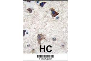 Image no. 2 for anti-Cadherin 4 (CDH4) (AA 182-211), (N-Term) antibody (ABIN356865) (Cadherin 4 Antikörper  (N-Term))